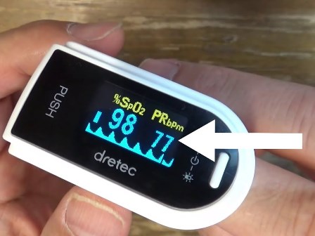 Pulse in normal oximeter rate What is